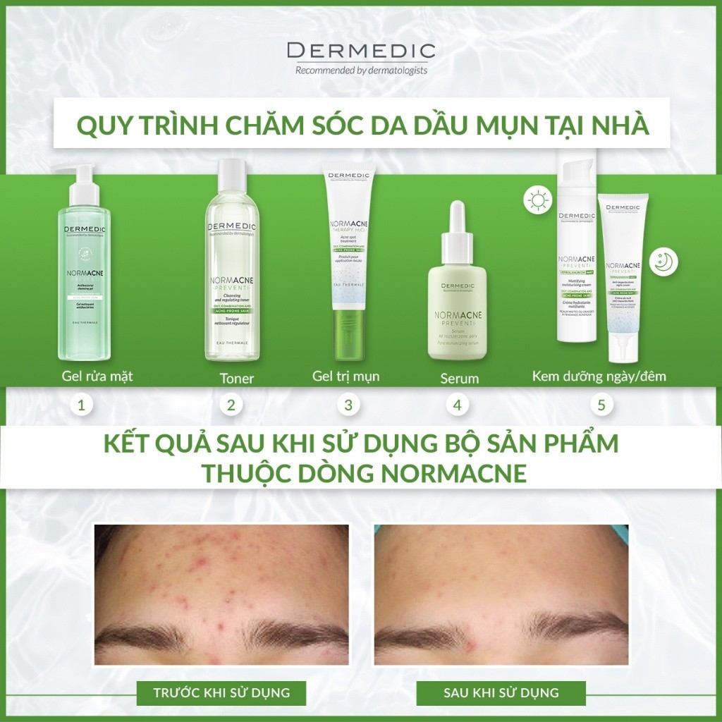 Combo 2 Toner Dermedic da dầu mụn làm dịu se khít lỗ chân lông Normacne Preventi Cleansing & Regulating Skin Toner 200ml