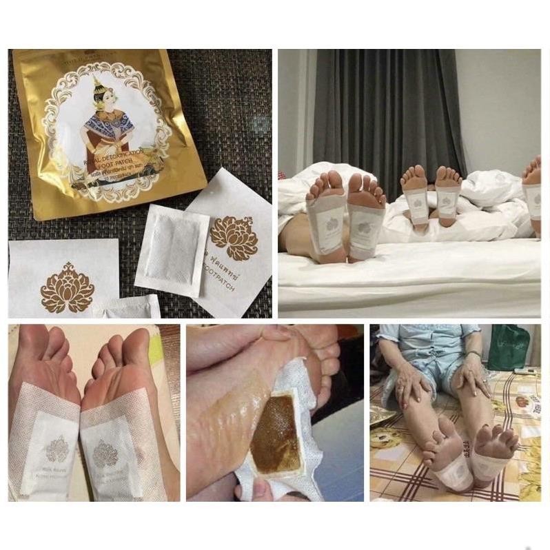 [Hàng Chuẩn] Miếng Dán Thải Độc Chân Gold Princess Royal Nội Địa Thái Lan [1 Gói 10 miếng]