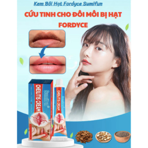 Kem bôi môi hạt FORDYCE SUMIFUN ITALY - dưỡng môi SUMIFUN ITALY  cứu tinh cho đôi môi bị FORDYCE