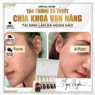[1 lọ] Vi Kim Tảo Biển Dermapeel+ Trứng Cá Tuyết- Peel Da Phục Hồi Da Mụn Chuẩn Spa