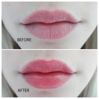 Dưỡng môi VASELINE 7g ( Dạng Hũ )