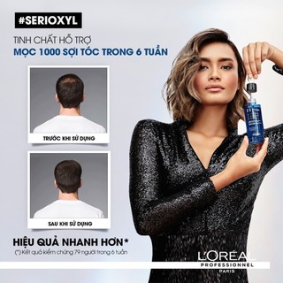 Tinh chất xịt mọc tóc - làm dày tóc L'Oréal Professionel Serioxyl Advanced 90ml