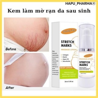 Kem rạn da stretch marks cream hỗ trợ mờ rạn da, mờ sẹo thâm, đều màu sau sinh 30ml