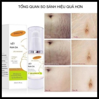 Kem rạn da stretch marks cream hỗ trợ mờ rạn da, mờ sẹo thâm, đều màu sau sinh 30ml