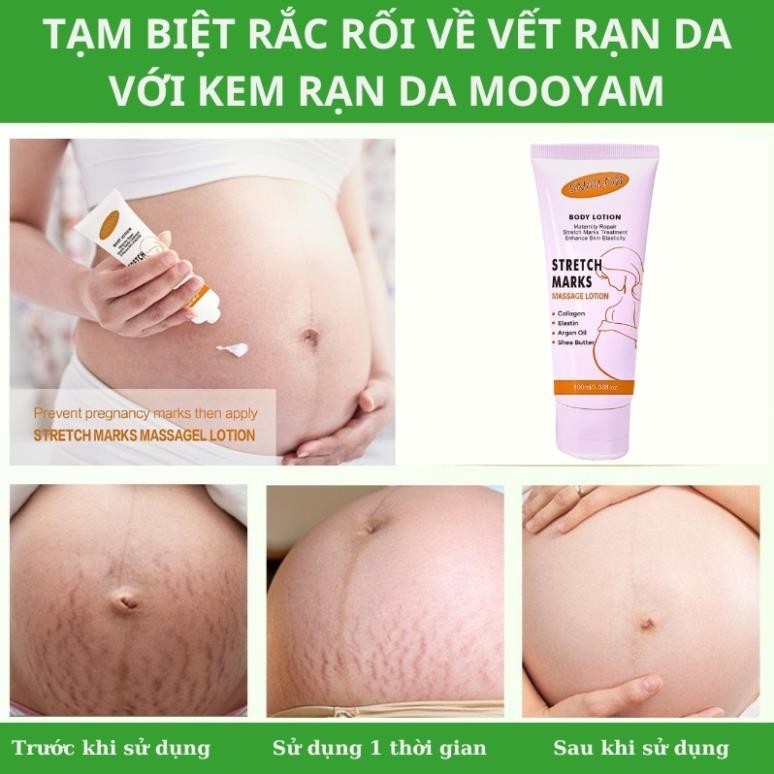 Kem rạn da SNMLPM hỗ trợ giảm sẹo sau sinh Kem dạn da sau sinh làm trắng và săn chắc mịn màng TP07