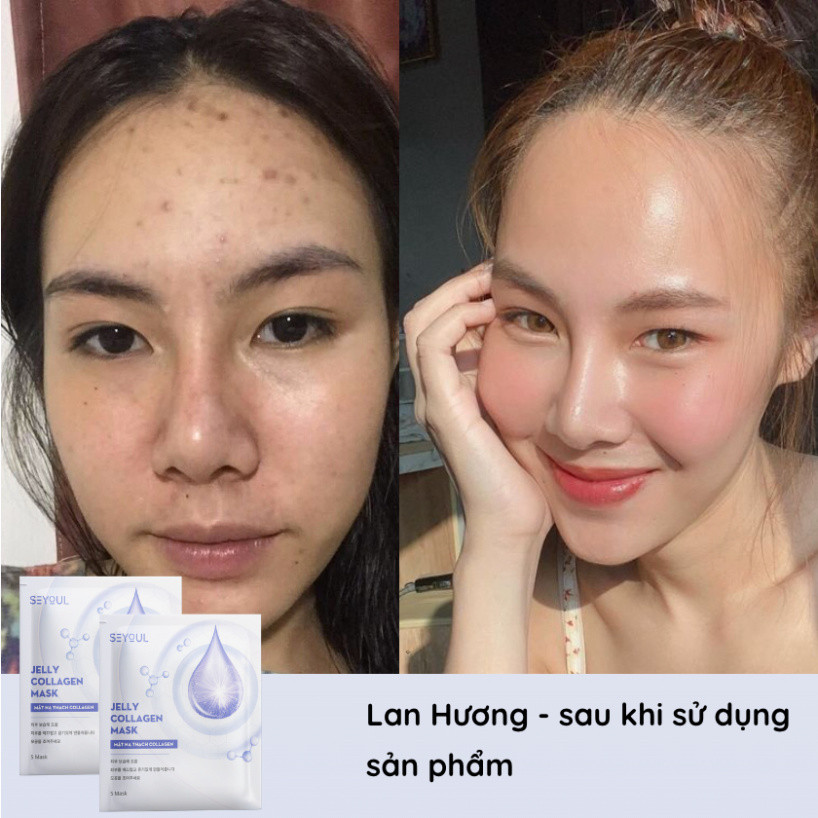 Mặt nạ thạch Collagen Seyoul Hàn Quốc, Jelly Collagen Mask Dưỡng Trắng Cấp ẩm Da Căng Bóng Mịn Màng 1 Hộp x 5 miếng