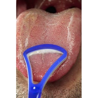 Dụng Cụ Cạo Lưỡi tiện dụng