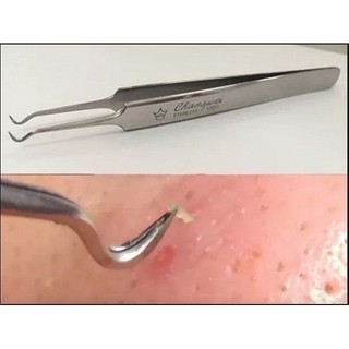 Nhíp Gắp Mụn Thần Kỳ