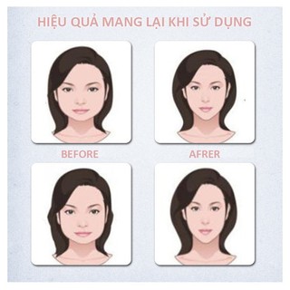 Đai Nâng Cơ Thon Gọn Mặt V-line