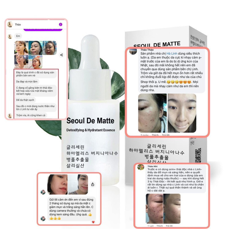 Thải độc seoul de matte lọ 10ml hạn 2027 làm sạch và cấp nước ban đêm rose de seoul (tặng Mặt Nạ)HN1