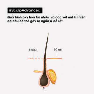 [GIFT ] Dầu gội dưỡng tóc dịu nhẹ giúp cân bằng da đầu chuyên nghiệp L'Oréal Professionnel Scalp Advanced 10ml