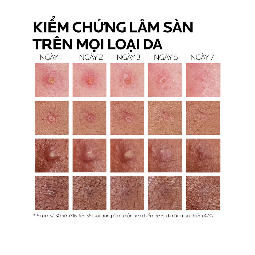 Kem dưỡng giảm mụn nhanh 8 giờ La Roche-Posay Effaclar Duo+ M 7.5ml | BigBuy360 - bigbuy360.vn