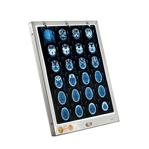 ĐÈN ĐỌC PHIM XQ THÀNH NHÂN TNE. ĐÈN ĐỌC 1 PHIM