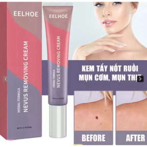 KEM EELHOE TẨY NỐT RUỒI, MỤN CƠM, MỤN THỊT, NÁM,ĐỒI MỒI... THÀNH PHẦN THẢO DƯỢC KHÔNG ĐỂ LẠI SẸO  - HTHshop102