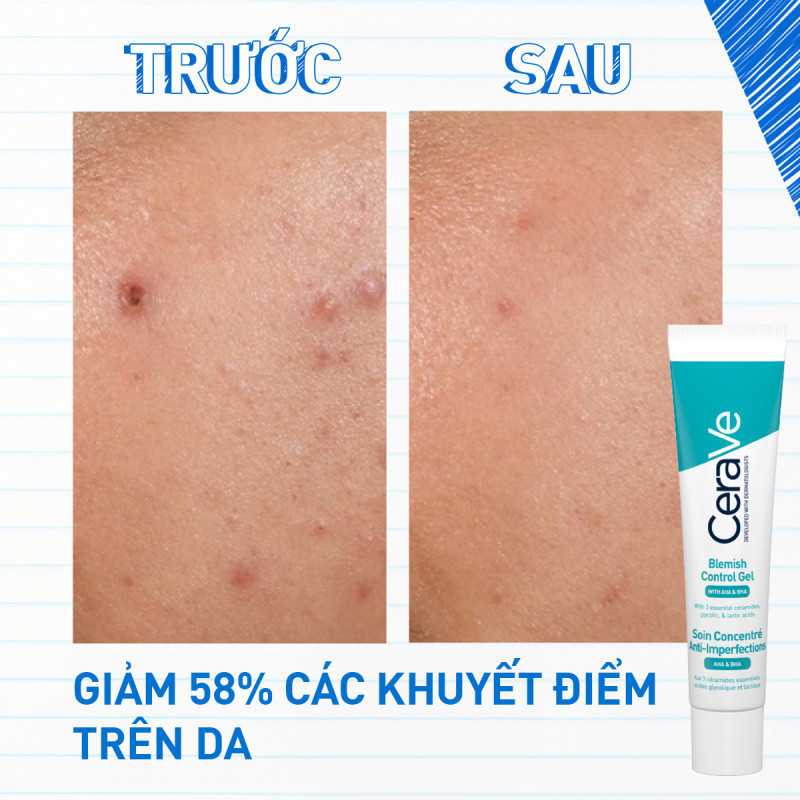 Gel Giảm Mụn Mờ Thâm Phục Hồi Làn Da CeraVe Blemish Control Gel 40ml | BigBuy360 - bigbuy360.vn
