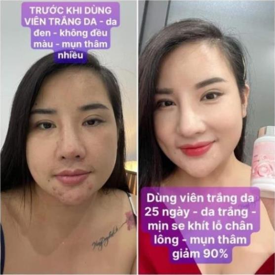 Glutathione,Viên uống trắng da hủy nám Glutathione, nâng tone nhanh, viên trắng da hủy nám tàn nhang