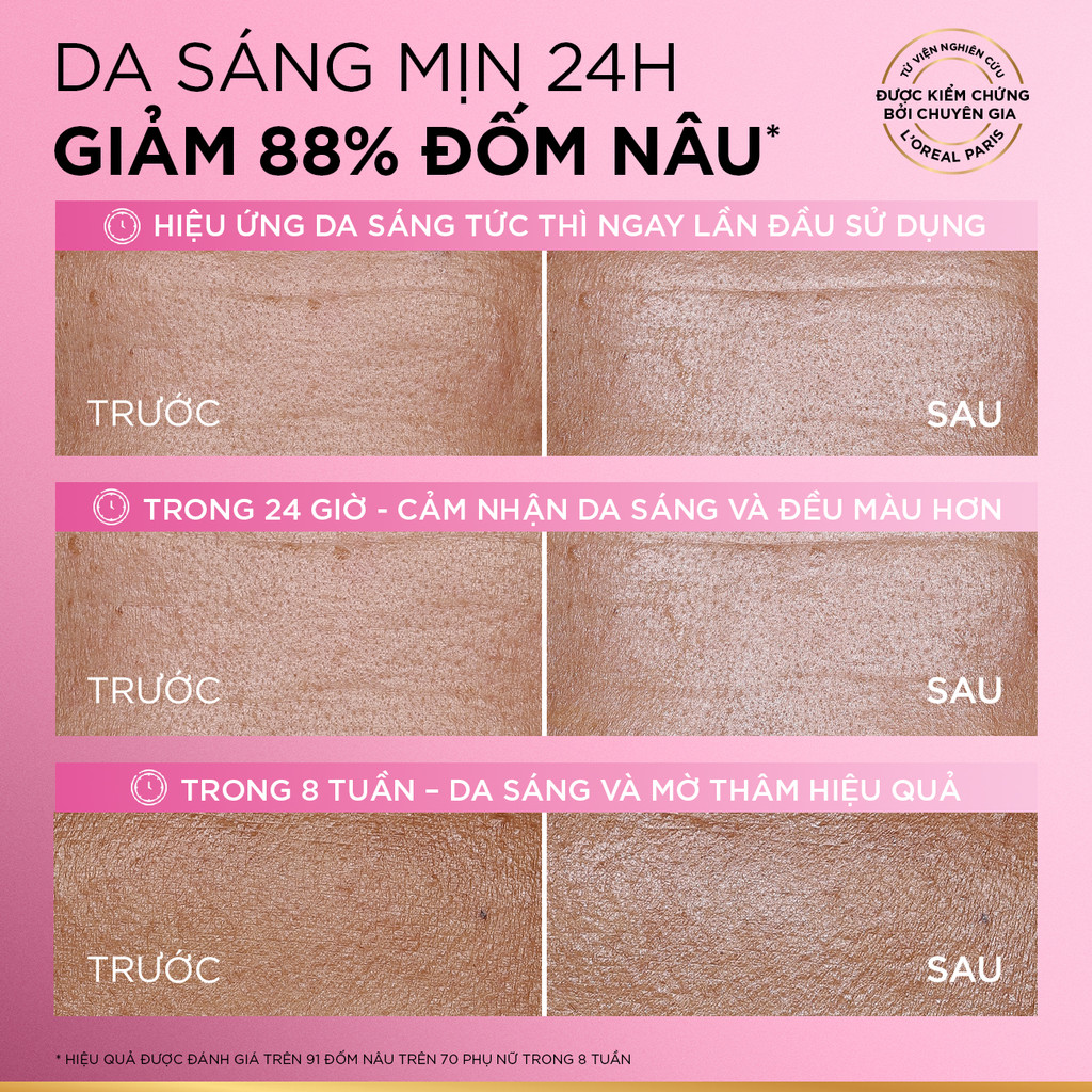 VB_ Bộ đôi serum & kem dưỡng sáng da đột phá Melasyl mờ thâm mụn, nám L'Oreal Paris Glycolic Bright 30ml, 50ml | BigBuy360 - bigbuy360.vn