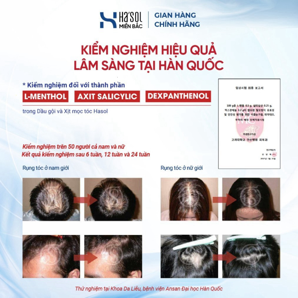 Xịt Dưỡng HASOL Kích Mọc, Ngăn Rụng, Nuôi Dưỡng Da Đầu Nang Tóc Chắc Khỏe - Ha'sol Anagen Active Ton