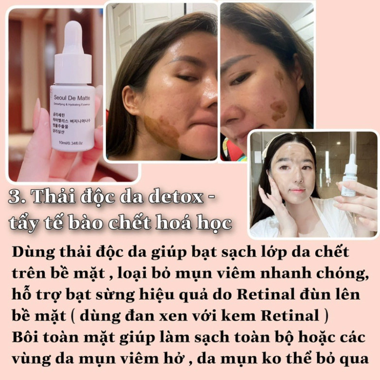 A  Serum làm sạch A.C.E thải độc Seoul de matte A