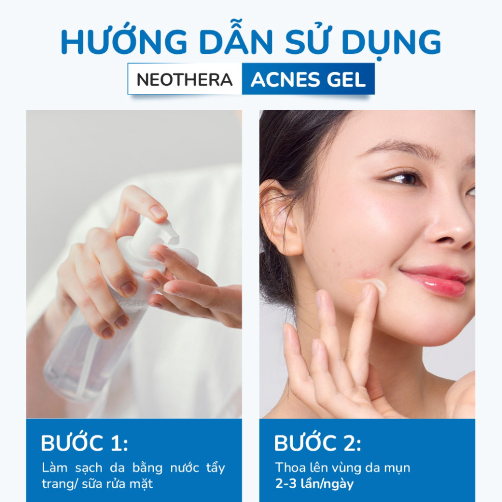 F Gel Giảm Mụn, Thâm Sẹo Mụn Dành Cho Da Dầu, Mụn NEOTHERA Acnes Gel 15ml (Tuýp) F