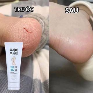 Kem Dưỡng Da Chân Urea Daiso Hàn Quốc Chăm sóc cấp ẩm gót nứt nẻ