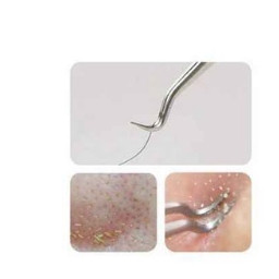 [LOẠI 1] Nhíp gắp mụn , gắp lông, gắp tóc, gắp mi
