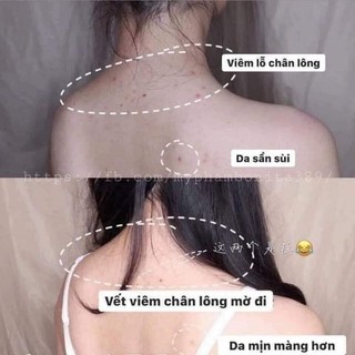XÀ PHÒNG  MỤN LƯNG FORBACK NỘI ĐỊA NHẬT