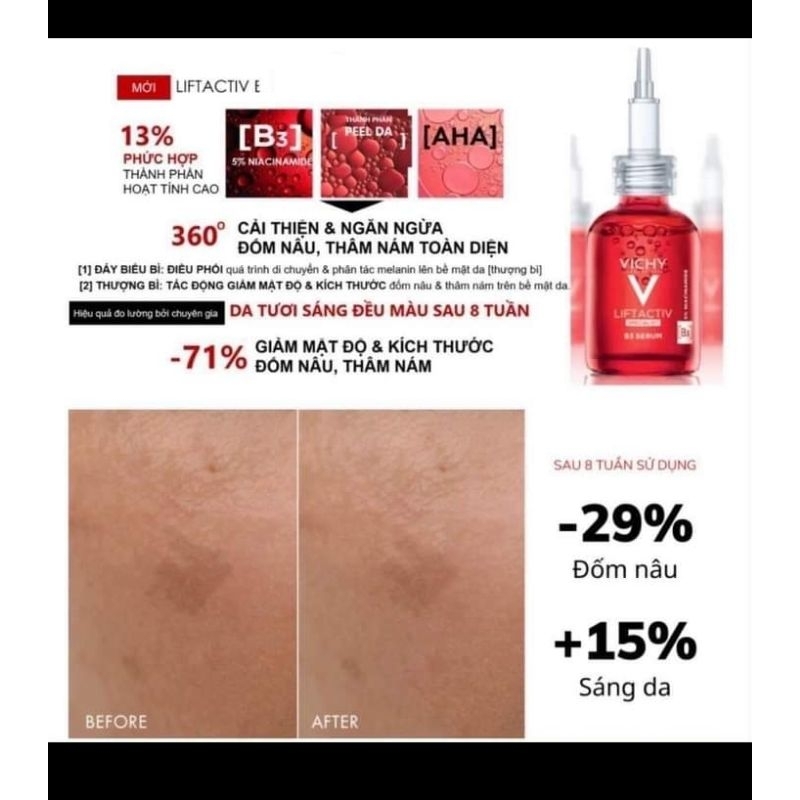 𝐓𝐢𝐧𝐡 𝐂𝐡𝐚̂́𝐭 𝐕𝐢𝐜𝐡𝐲 𝐋𝐚̀𝐦 𝐌𝐨̛̀ 𝐕𝐞̂́𝐭 𝐓𝐡𝐚̂𝐦 𝐕𝐚̀ 𝐍𝐞̂́𝐩 𝐍𝐡𝐚̆𝐧 𝟑𝟎𝐦𝐥 𝐋𝐢𝐟𝐭𝐀𝐜𝐭𝐢𝐯 𝐁𝟑 𝐒𝐞𝐫𝐮𝐦 𝐃𝐚𝐫𝐤 𝐒𝐩𝐨𝐭𝐬 & 𝐖𝐫𝐢𝐧𝐤𝐥𝐞