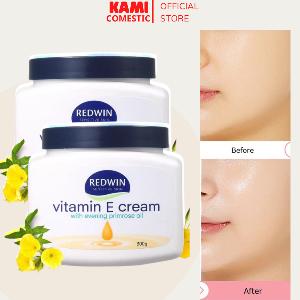 Kem Dưỡng Trắng Ẩm Mềm Mịn Da Mặt Và Body Redwin Vitamin E Cream, Vitamin E Chính Hãng 300g - KAMI