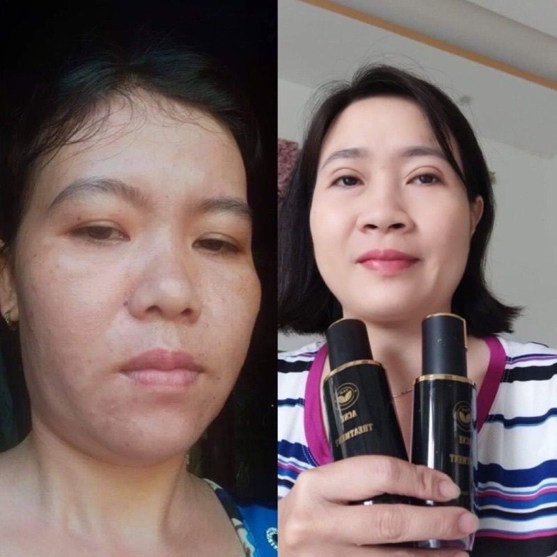 SERUM TÁI TẠO TRẦN KIM HUYỀN