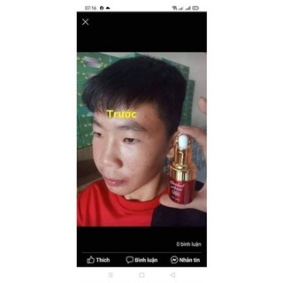 Serum Chấm mụn 12h Huỳnh Đỗ