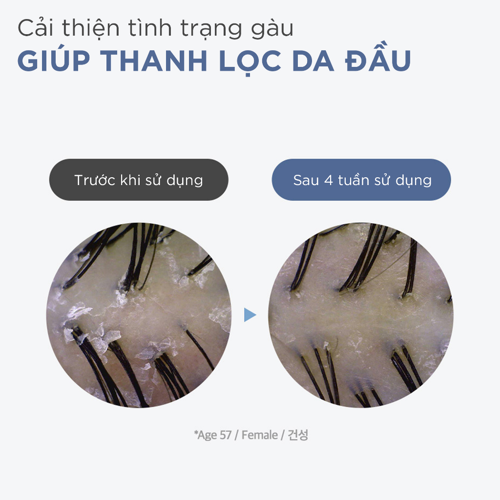 Dầu gội dành cho da đầu gàu ngứa sạch làm sâu da đầu và hỗ trợ mọc tóc Dr.FORHAIR Folligen Anti-Dandruff Shampoo 300ml | BigBuy360 - bigbuy360.vn