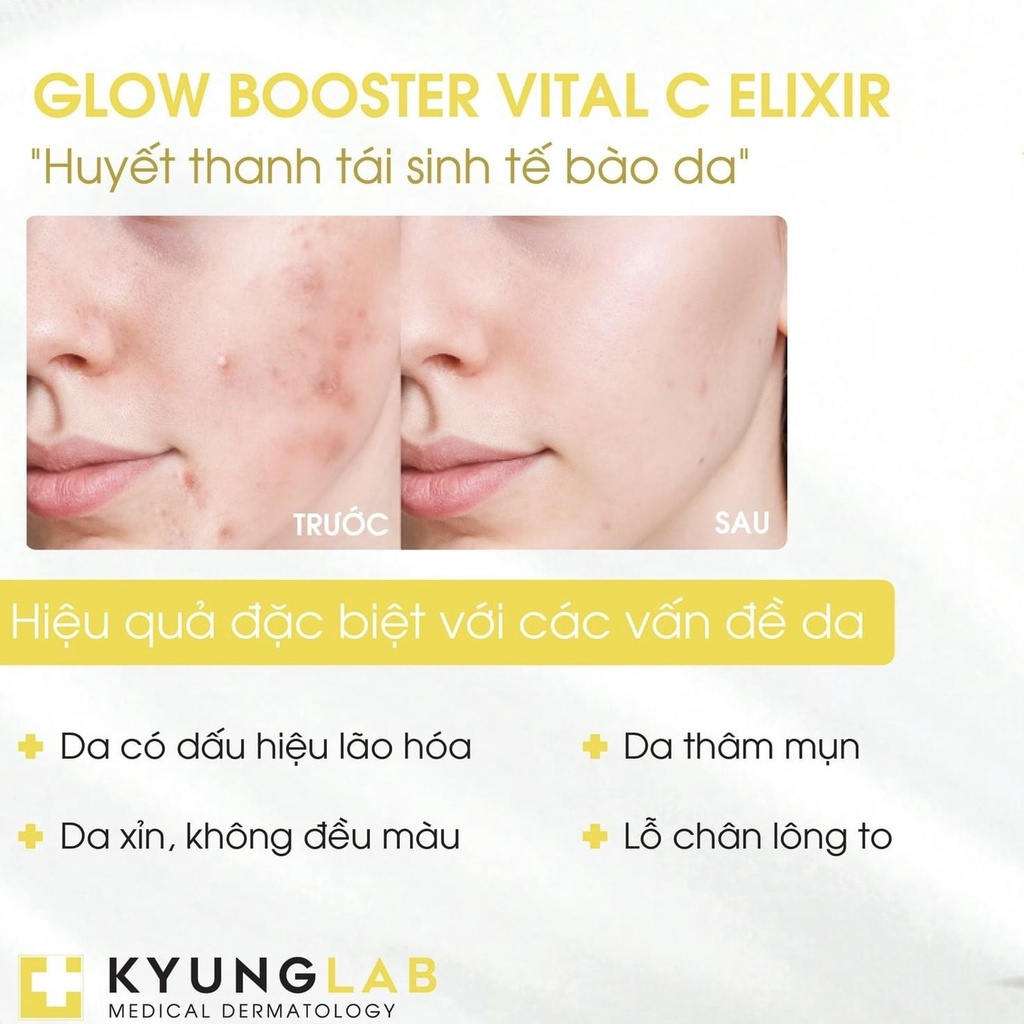 Serum Vitamin C KyungLab Glow Booster Vital C 30ml Mờ Vết Thâm, Sáng Da, Phục Hồi Làn Da, Căng Bóng Da - Gazumi Beauty