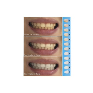 [HB Gift] Set 5 Miếng Dán Trắng Răng Halio Teeth Whitening Strip