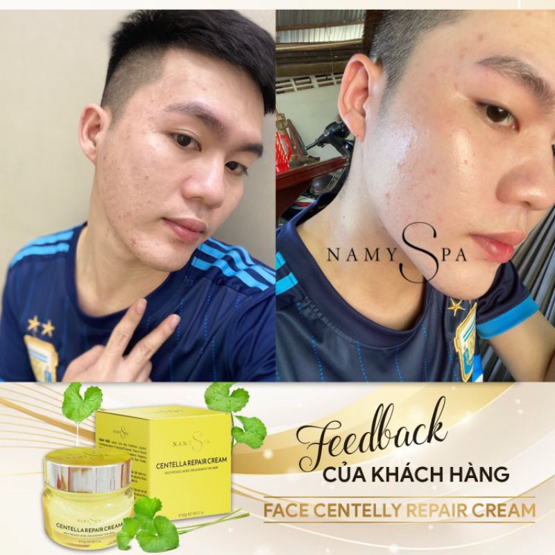 Kem face tri mụn Rau má - Namy Spa - giảm mụn, mờ thâm, trắng da