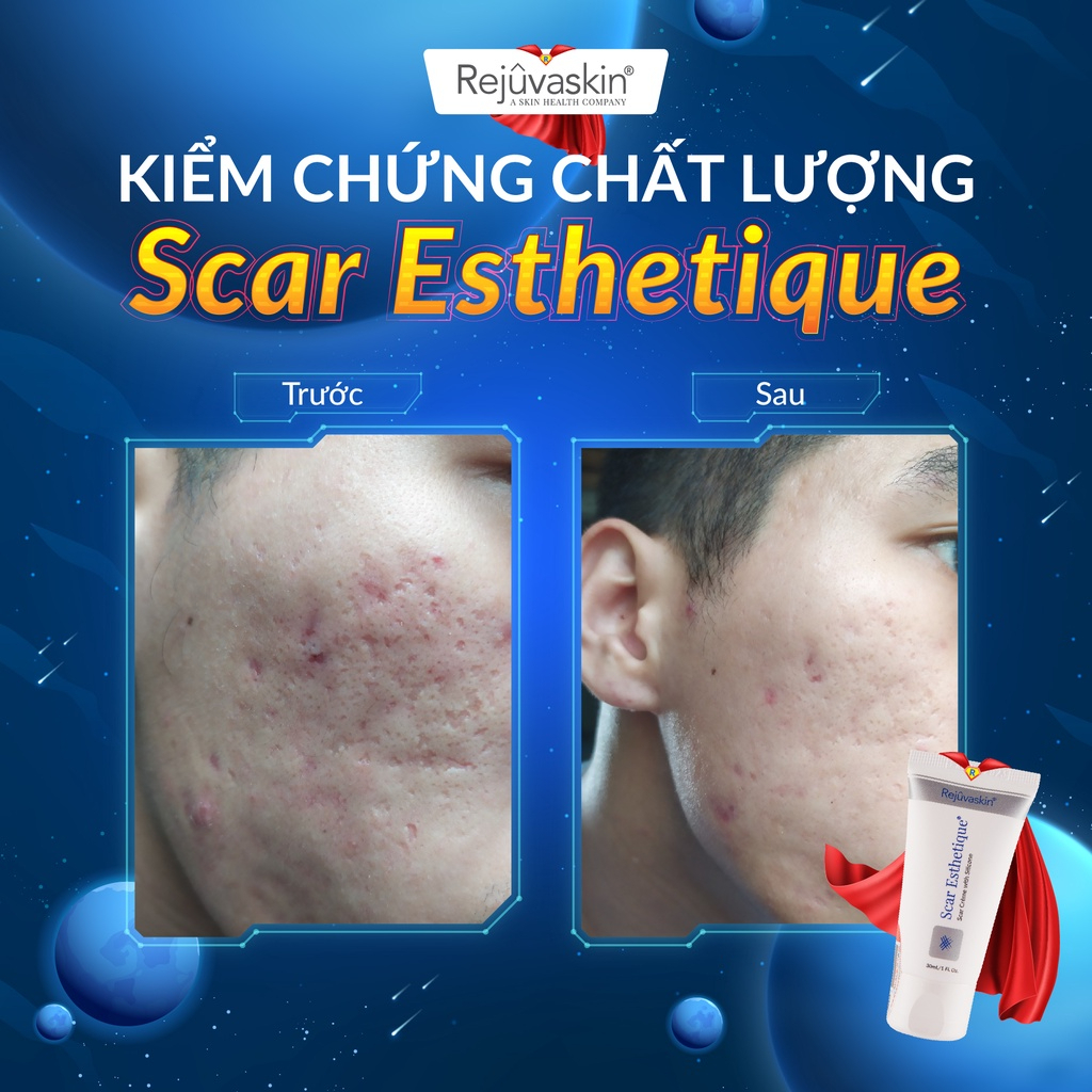 Kem xóa mờ Sẹo Thâm, Sẹo Rỗ, Sẹo Lõm Scar Esthetique của Rejuvaskin Hoa Kỳ