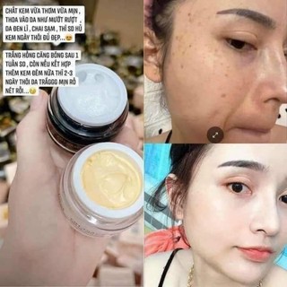Kem cốt nám đông y nicos thanh nhi chính hãng