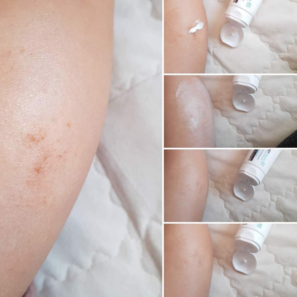 Kem Dưỡng La Roche-Posay Cicaplast Baume [B5+] Bổ Sung Lợi Khuẩn, Thấm Thấu Nhanh