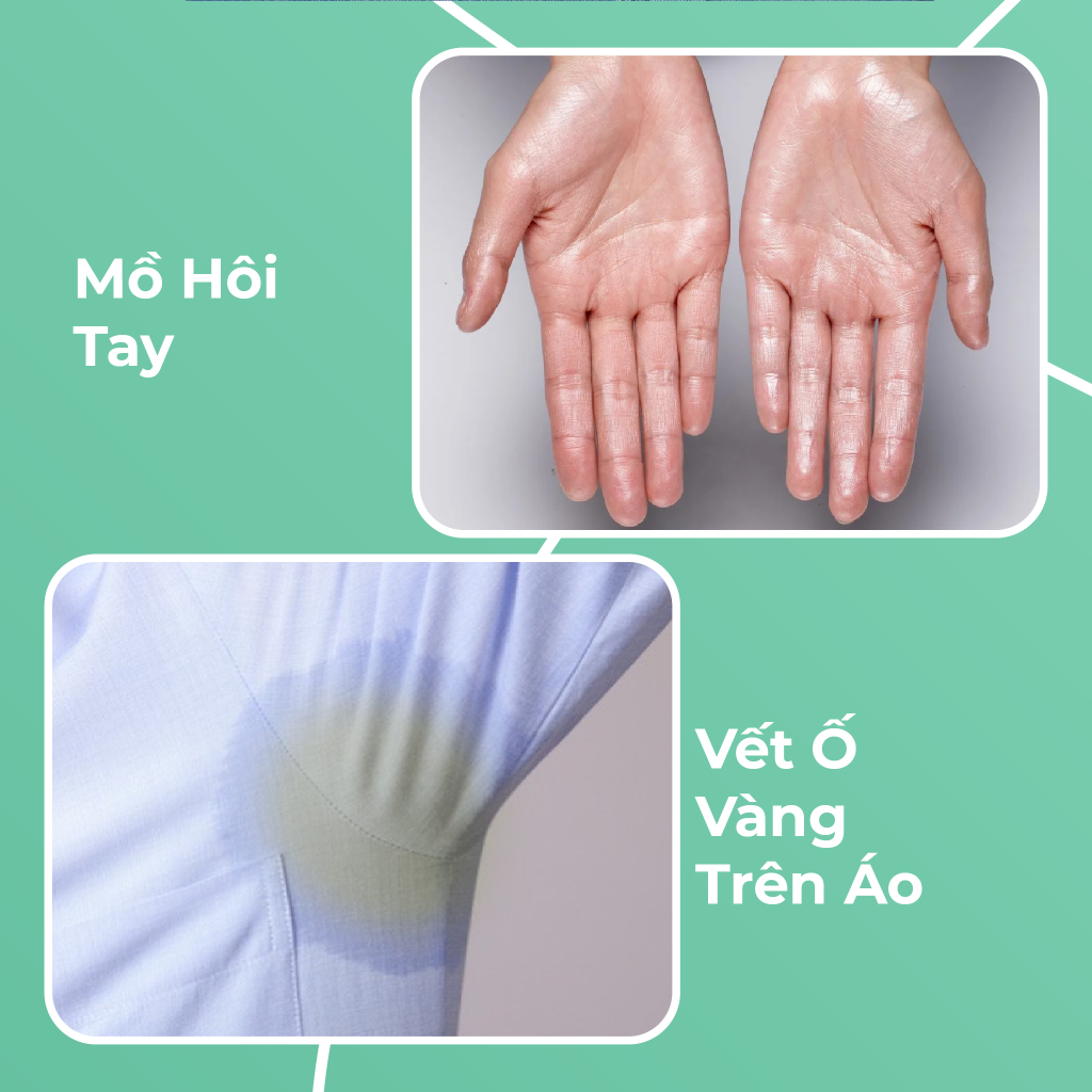 Khử mùi hôi nách Colaco 20ml Trị Hôi Nách Hôi Chân Giảm Thâm Da, Hạn Chế Tiết Mồ Hôi Nách, Tay Chân