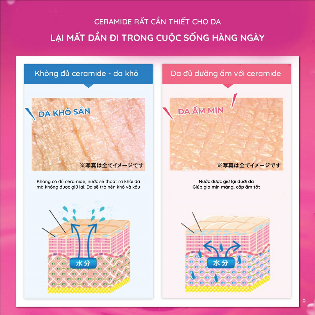 Thạch collagen Nhật Bản Aishitoto Collagen Jelly Ceramide Plus vị Acai 30 thanh