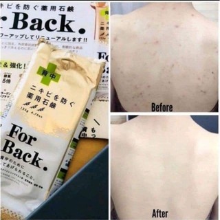 XÀ PHÒNG  MỤN LƯNG FORBACK NỘI ĐỊA NHẬT