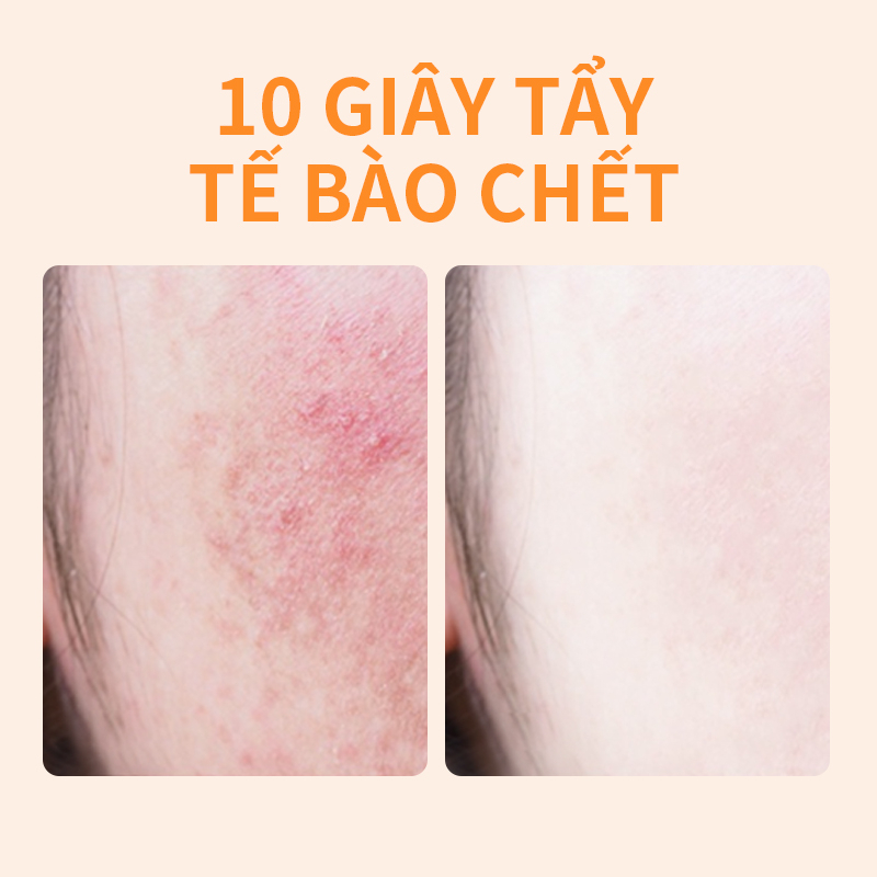 2PCS Tẩy Tế Bào Chết Da Mặt Dịu Nhẹ Đặt GMEELAN Exfoliate Gel Set Làm Trắng Da Sạch Sâu Lỗ Chân 50g+50g