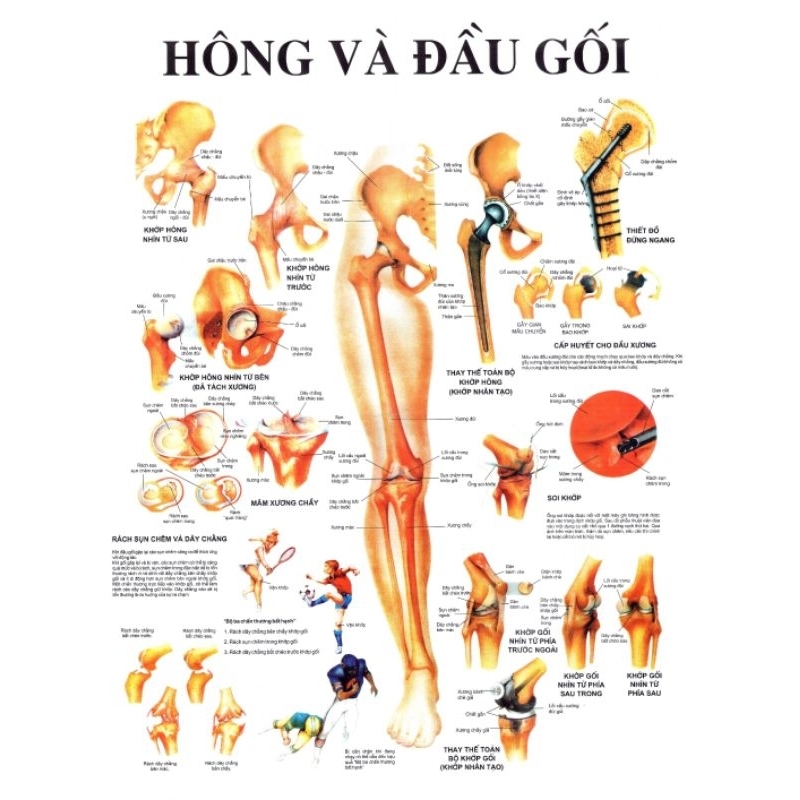 Tranh giải phẫu hông và đầu gối 70×90cm