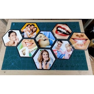 Sét tranh nha khoa lục giác chất liệu Fomex