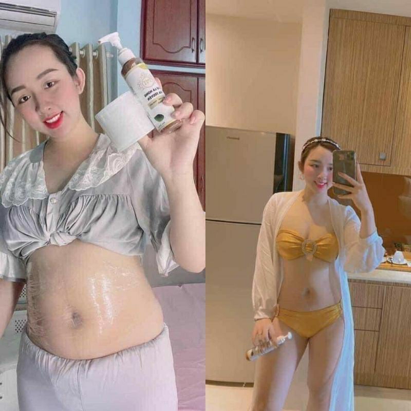 Combo CAO LÁ NÓNG GIA TRUYỀN - 200ml - TẶNG KÈM QUẤN + THƯớC DÂY