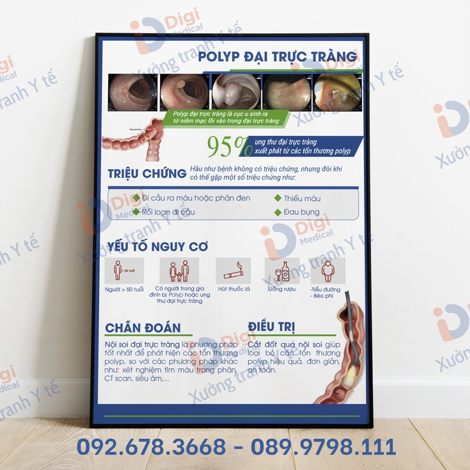 (Tranh Decal Dán) Tranh Polyp Đại Trực Tràng