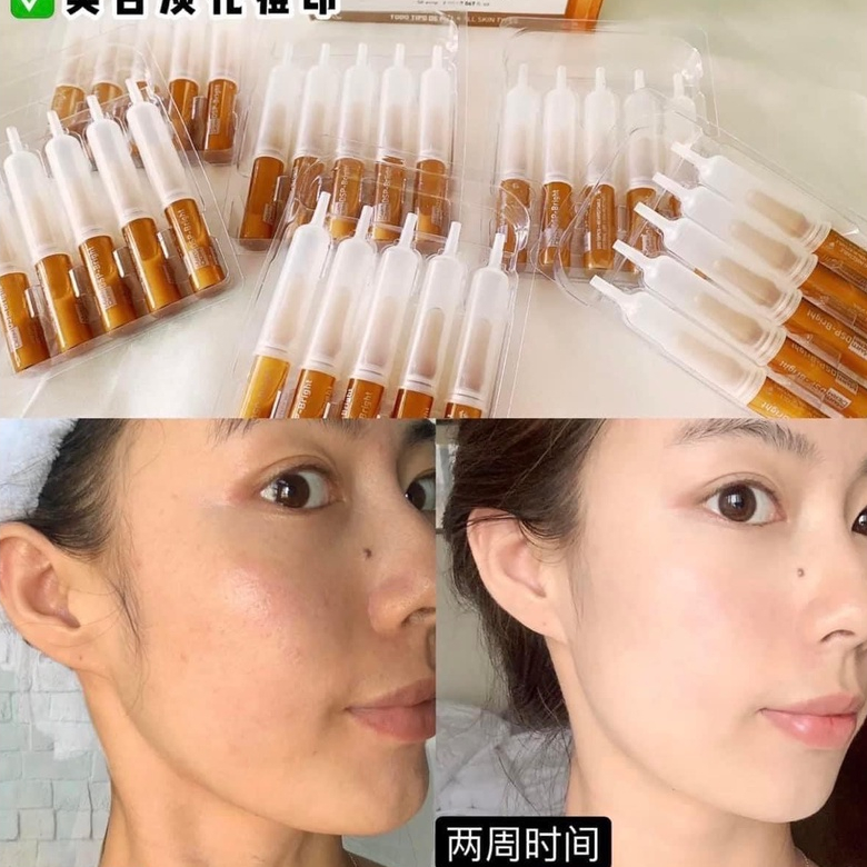 Serum  MartiDerm Pigment Zero Bright dưỡng sáng da LS