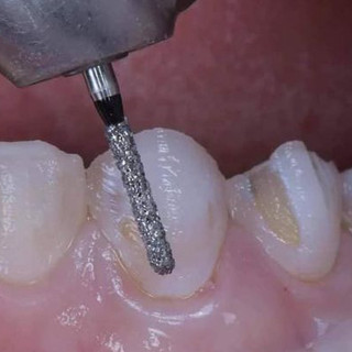 Mũi khoan nha khoa Mani chính hãng,vỉ 5 mũi khoan hãng Mani chuyên mài răng