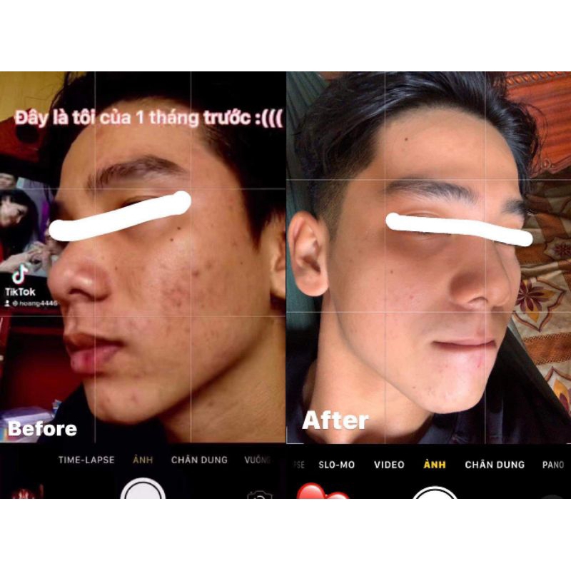 SERUM RIIBE  tặng 30ml sữa rửa mặt riibe +quà
