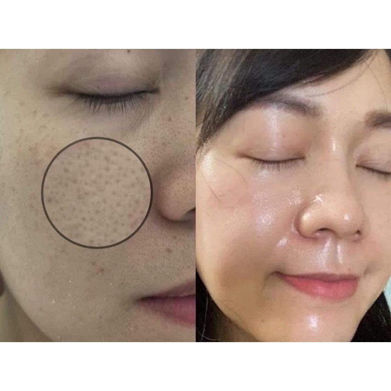 Sữa rửa mặt chanh đường đen